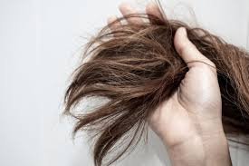 Haircare-Tips-for-Winters-12.jpg